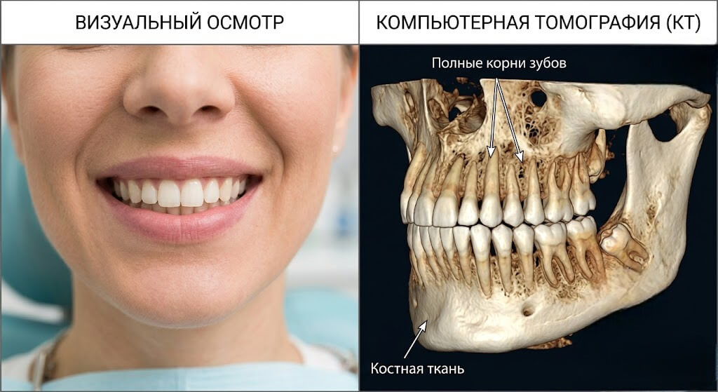 Разница КТ и визуального осмотра